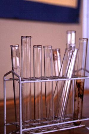 歯の治療することの安佐南区で大切な意味