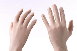 インプラントで美しい口内に仕上げる