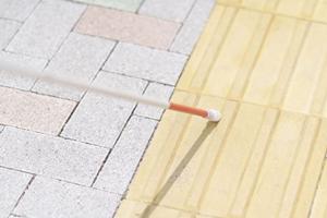 平尾の歯医者でインビザラインの相談