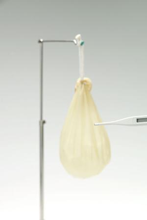 歯周病の治療を新発田市でしてもらう